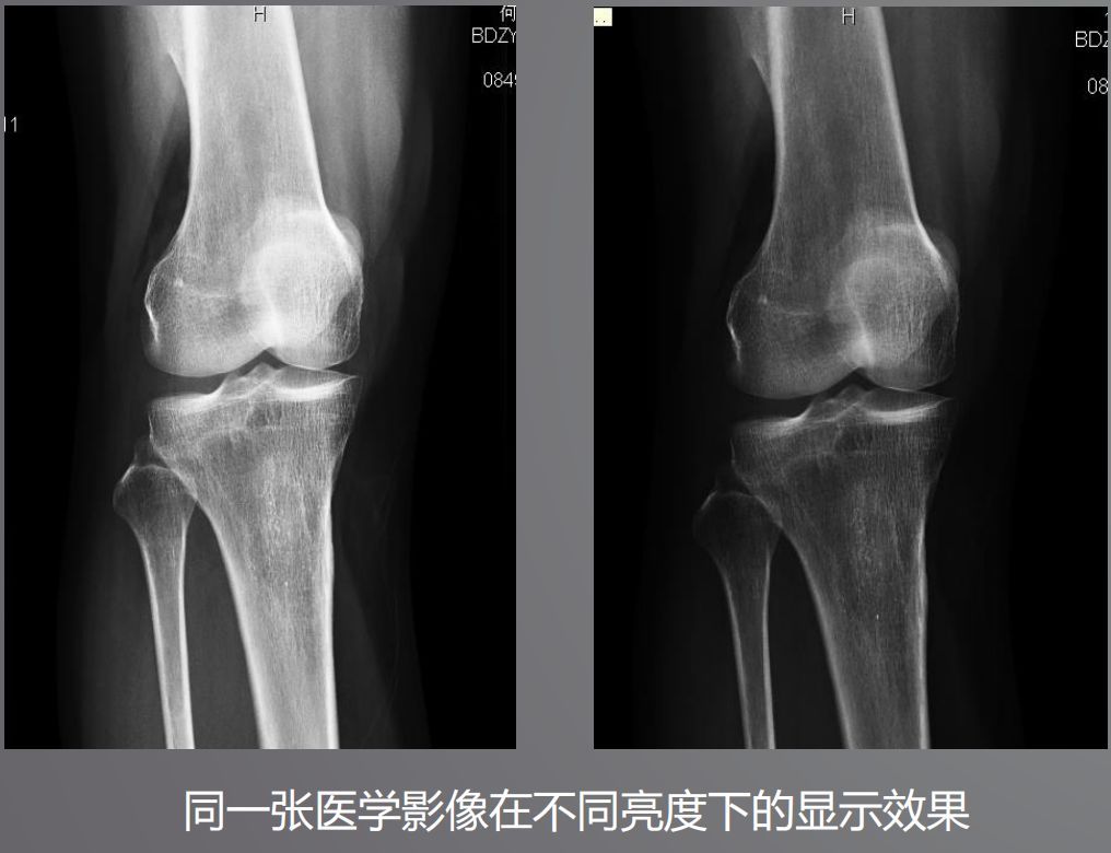 寵物DR設(shè)備的顯示器有要求？普通和醫(yī)用顯示器有什么區(qū)別