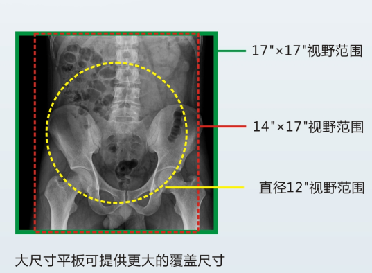 動(dòng)態(tài)DR成像視野